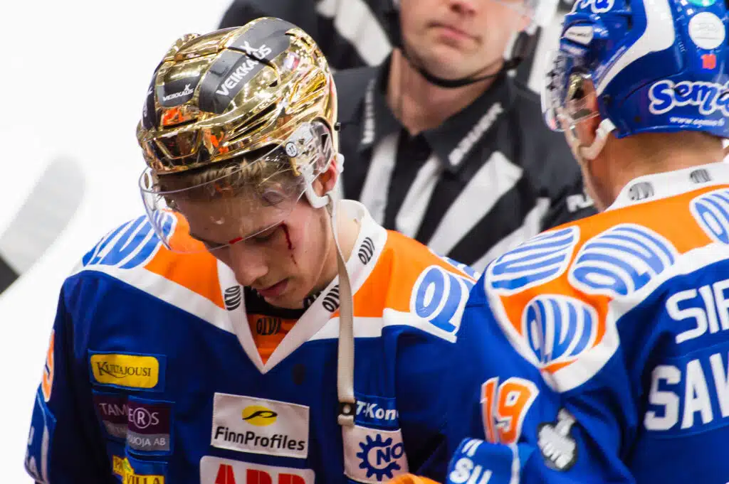 Aleksander Barkovin lapsuudenystävä pääsi pelaamaan NHL:ssä – myönsi karun totuuden tuosta reissusta